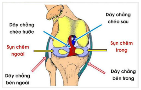 ĐỨT DÂY CHẰNG CHÉO ĐẦU GỐI: NGUYÊN NHÂN, DẤU HIỆU VÀ CÁCH ĐIỀU TRỊ