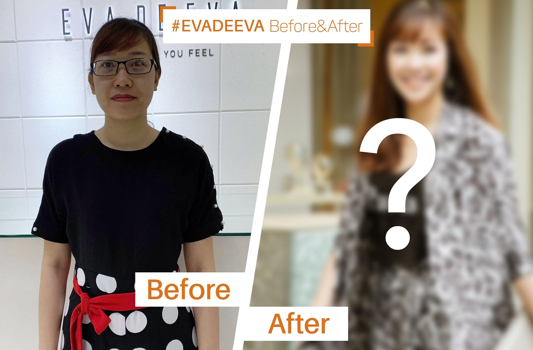 BEFORE & AFTER |  CHỌN GIA ĐÌNH HAY NHAN SẮC?