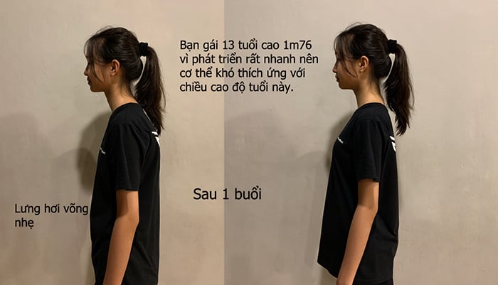 khóa học chữa gù lưng tại hà nội