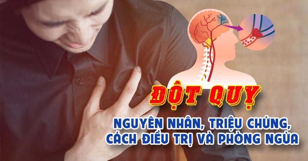 Nguyên nhân đột quỵ là gì? Đối tượng dễ bị đột quỵ và phương pháp phòng ngừa