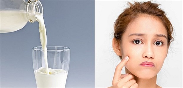 Sữa có phải nguyên nhân gây ra mụn trên da?