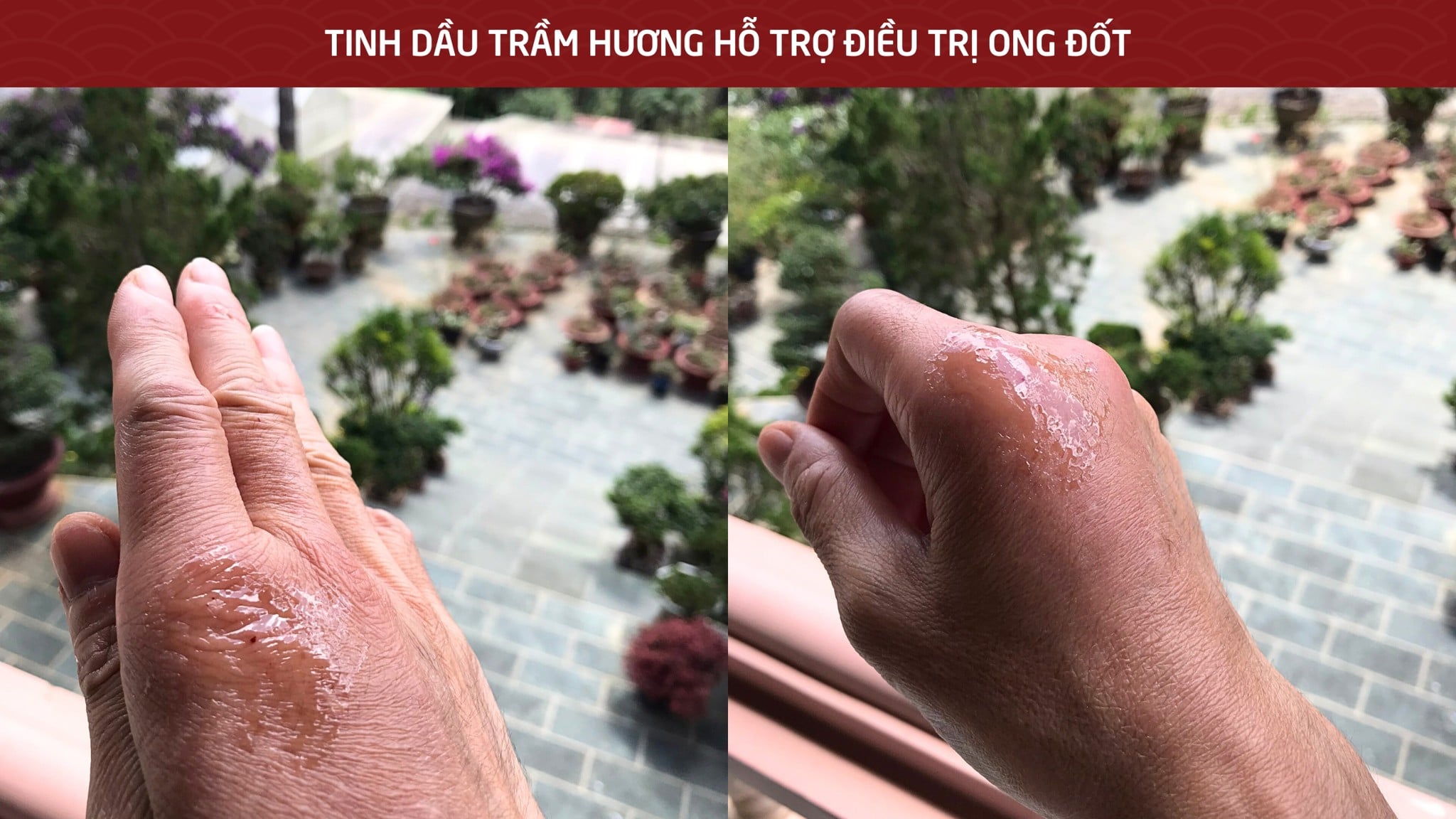 Tinh dầu Trầm hương hỗ trợ điều trị ong đốt