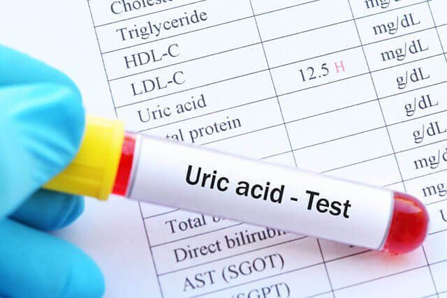 Xét nghiệm Uric acid