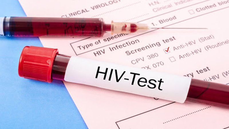 Thời điểm xét nghiệm HIV cho kết quả chính xác