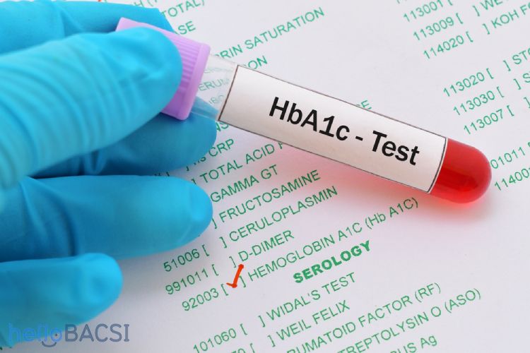 Xét nghiệm HbA1c trong bệnh tiểu đường có quan trọng không?