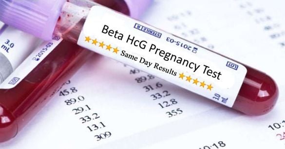 Nồng độ Beta HCG bao nhiêu thì có thai? và nồng độ Beta HCG cũng thay đổi theo tuổi thai?