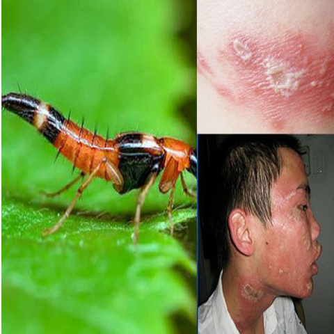 Mẹo Diệt Kiến Ba Khoang Vào Mùa Hè Hiệu Quả Tận Gốc: Bảo Vệ Cả Gia Đình An Toàn