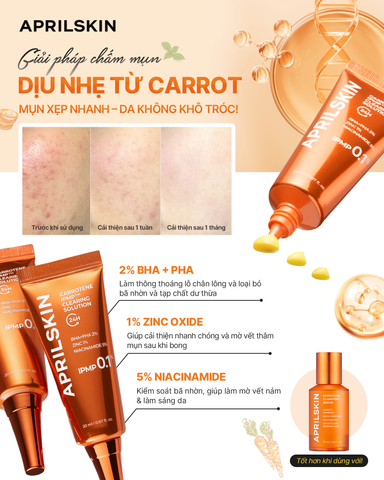 🌟 MỤN XẸP NHANH – DA VẪN MỊN MÀNG