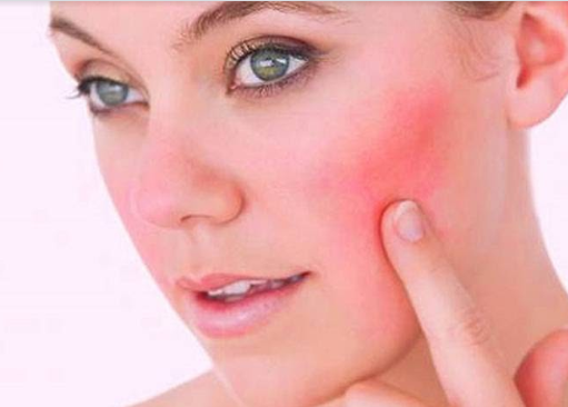 Da nhạy cảm: 6 dấu hiệu bạn mắc phải và cách chăm sóc da