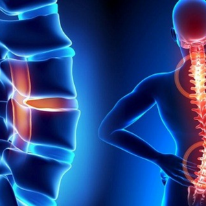 Glucosamine là gì? Tác dụng & Gợi ý sản phẩm bổ sung Glucosamine tốt nhất hiện nay