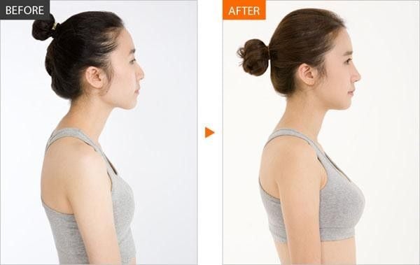 Hình ảnh bài viết