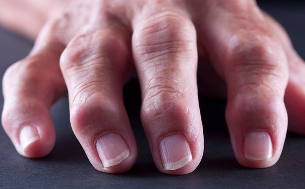 Hình ảnh bài viết