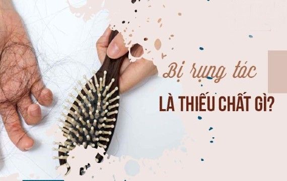 Hình ảnh bài viết