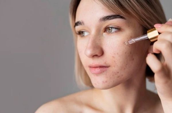 Hình ảnh bài viết