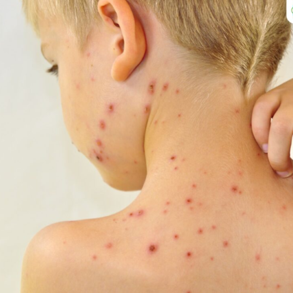 Hình ảnh bài viết