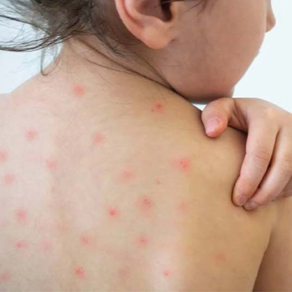 Hình ảnh bài viết