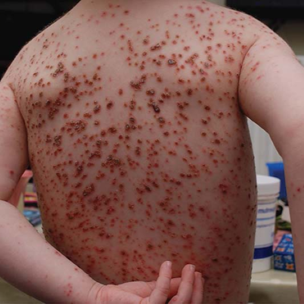 Hình ảnh bài viết