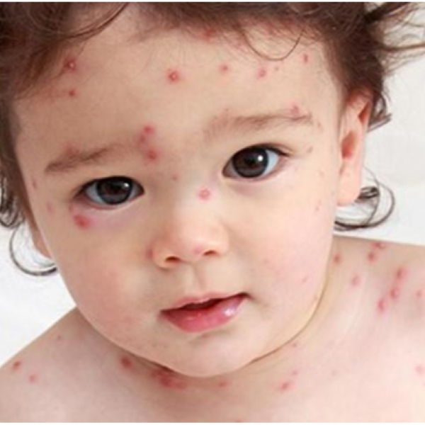 Hình ảnh bài viết