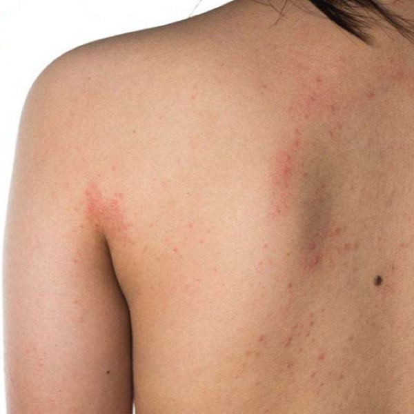 Hình ảnh bài viết