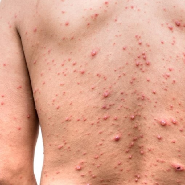 Hình ảnh bài viết