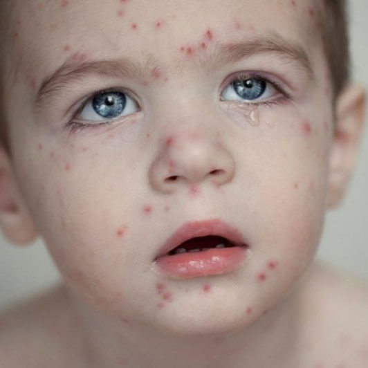 Hình ảnh bài viết