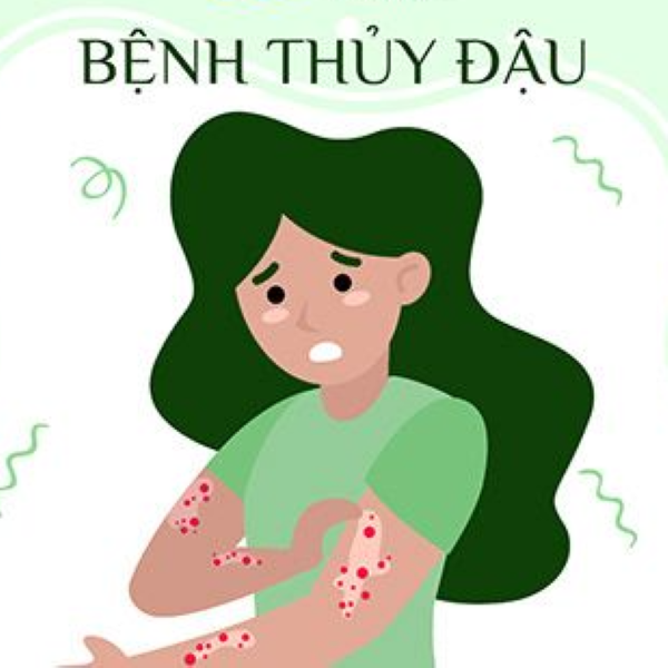 Hình ảnh bài viết