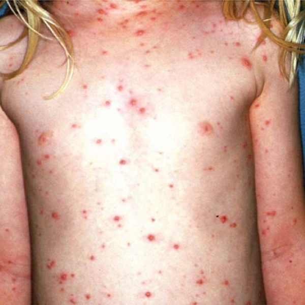 Hình ảnh bài viết