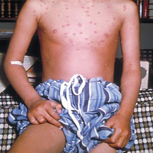 Hình ảnh bài viết