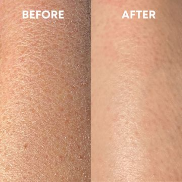 Hình ảnh bài viết