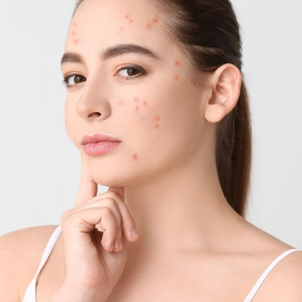 Hình ảnh bài viết