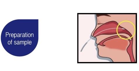 Hình ảnh bài viết