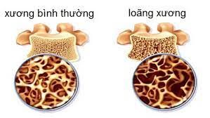 Hình ảnh bài viết