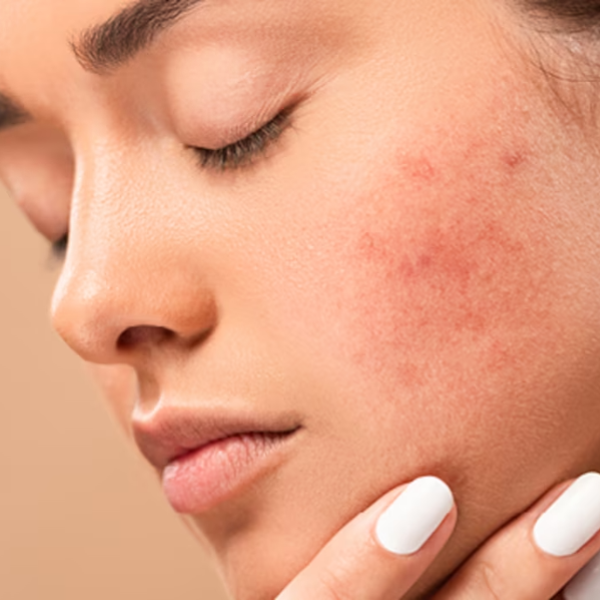 Hình ảnh bài viết