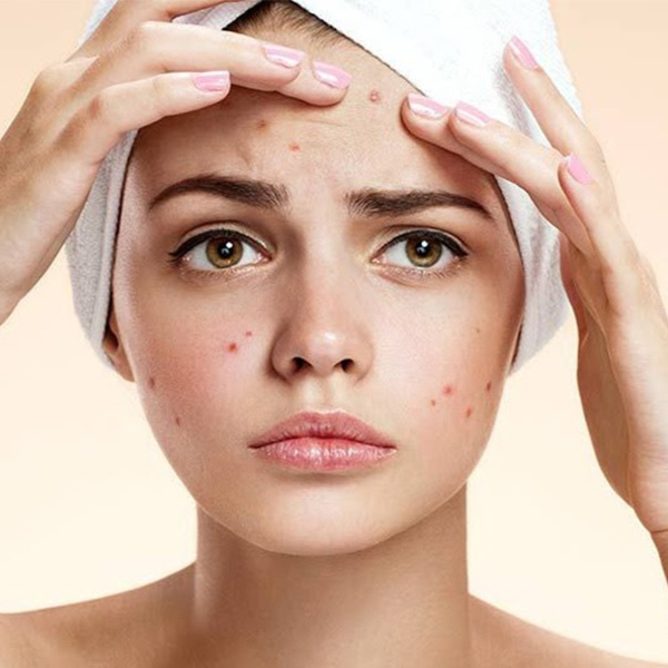 Hình ảnh bài viết