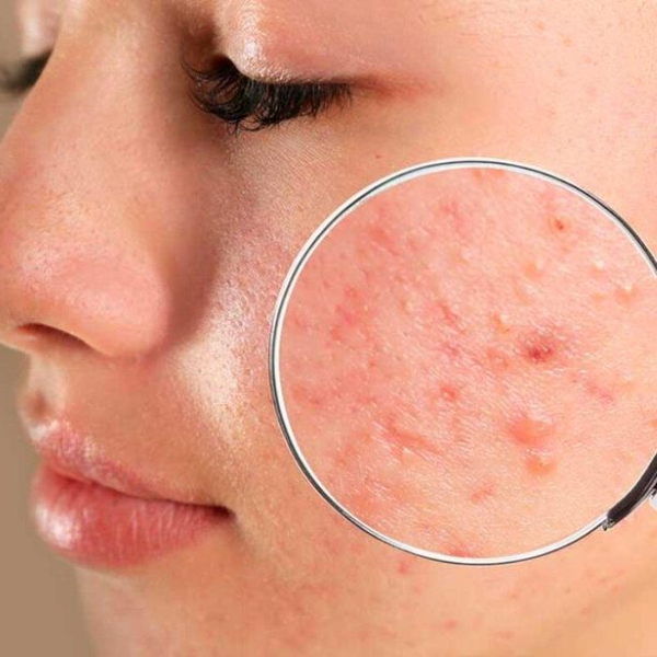 Hình ảnh bài viết