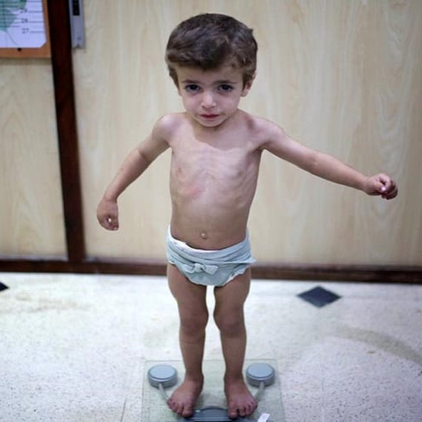 Hình ảnh bài viết