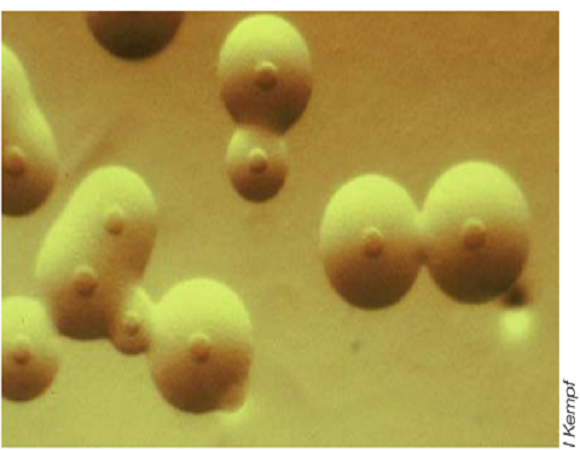 MYCOPLASMA SYNOVIAE (MS) MẦM BỆNH MỚI NỔI GÂY THIỆT HẠI CHO CHĂN NUÔI GIA CẦM