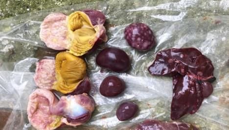 Khối u ở gan, lách, dạ dày tuyến, dây thần kinh đùi do Marek