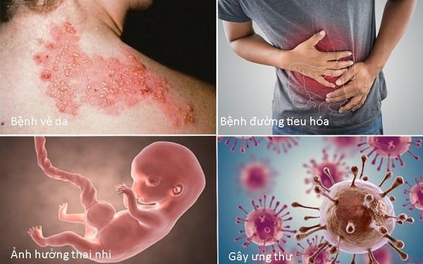 Ô nhiễm môi trường nước tác động tiêu cực đến sức khỏe con người