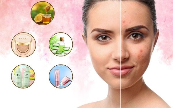 Cách trị vết thâm trên mặt hiệu quả giúp bạn tự tin rạng ngời hơn