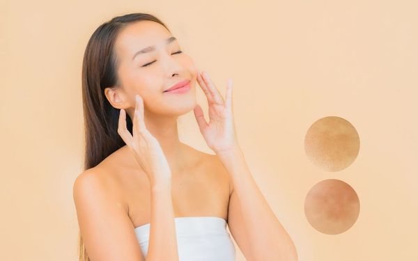 Cách chăm sóc da bị nám và tàn nhang để tự tin sở hữu làn da đẹp, rạng rỡ
