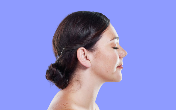 Da tự nhiên nổi đồi mồi, nên làm sao?