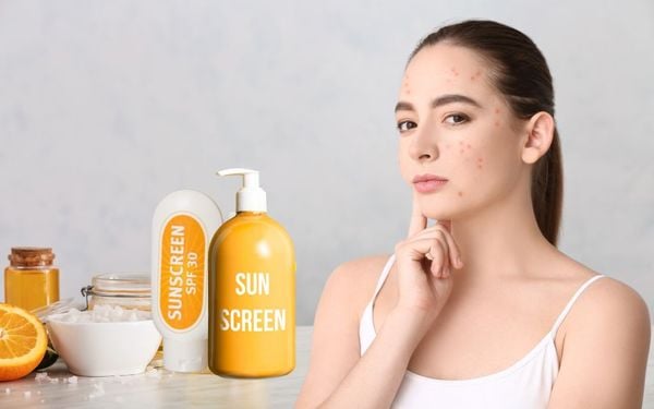 Dị ứng kem chống nắng là gì? Nên xử lý thế nào khi bị dị ứng kem chống nắng