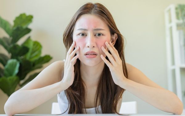 Dị ứng mỹ phẩm: Nguyên nhân, triệu chứng và mẹo sử dụng đúng cách