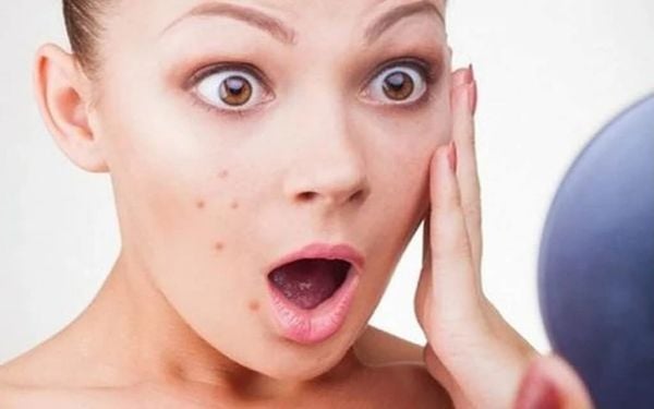 Dị ứng sữa rửa mặt: Nguyên nhân, triệu chứng và cách phòng tránh