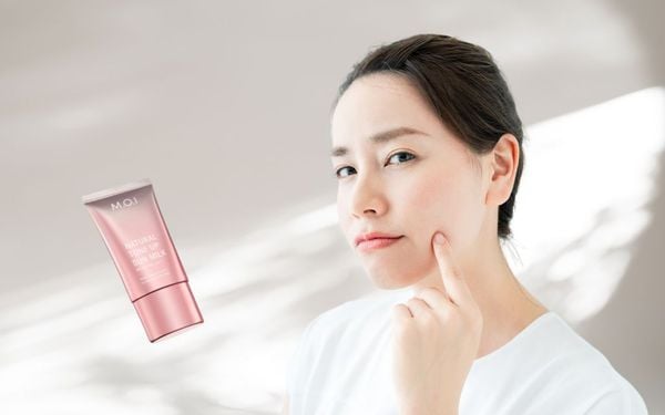 Bị mụn có nên bôi kem chống nắng không? Đâu là giải pháp an toàn cho da