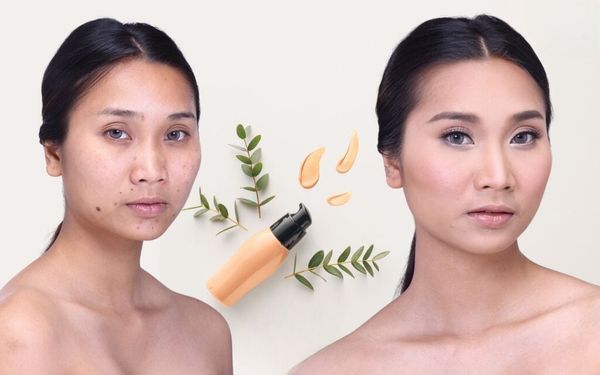 Kem che khuyết điểm có che được nốt ruồi không?