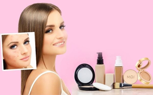 Làm sao để đánh lớp nền cho da mụn trở nên đẹp mịn màng?