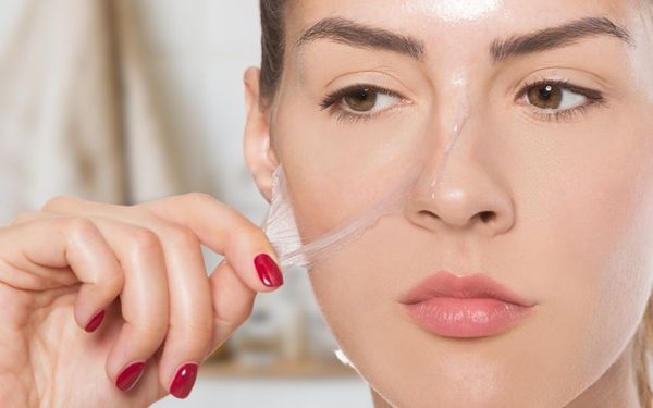 4 cách làm mặt nạ lột mụn từ thiên nhiên hiệu quả đến bất ngờ