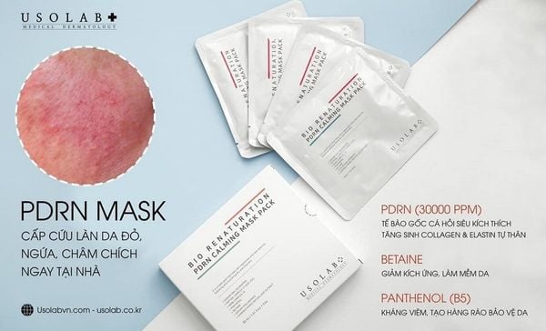 Mặt nạ Usolab: Thành phần và cách sử dụng hiệu quả